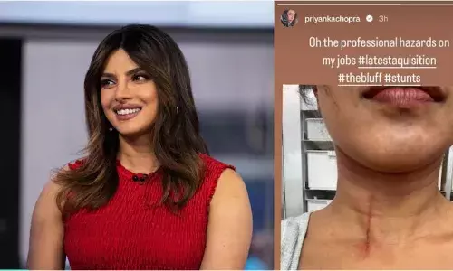 പ്രിയങ്ക ചോപ്രയ്ക്ക് കഴുത്തില് പരിക്കേറ്റു പ്രിയങ്ക ചോപ്രയ്ക്ക് കഴുത്തില് പരിക്കേറ്റു