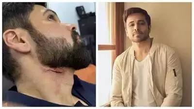ആദിവി ശേഷ്- വിനയ് കുമാർ സിരിഗിനിദി ചിത്രം ഗൂഢാചാരി 2 സെറ്റിൽ അപകടം; ബോളിവുഡ് താരം ഇമ്രാൻ ഹാഷ്മിക്ക് പരിക്ക് ആദിവി ശേഷ്- വിനയ് കുമാർ സിരിഗിനിദി ചിത്രം ഗൂഢാചാരി 2 സെറ്റിൽ അപകടം; ബോളിവുഡ് താരം ഇമ്രാൻ ഹാഷ്മിക്ക് പരിക്ക്