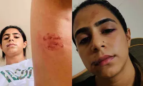 അയാള്‍ എന്റെ വയറ്റില്‍ ചവിട്ടി, തല തറയില്‍ ഇടിച്ചു, കക്ഷത്തും തുടകളിലും കടിച്ചു!