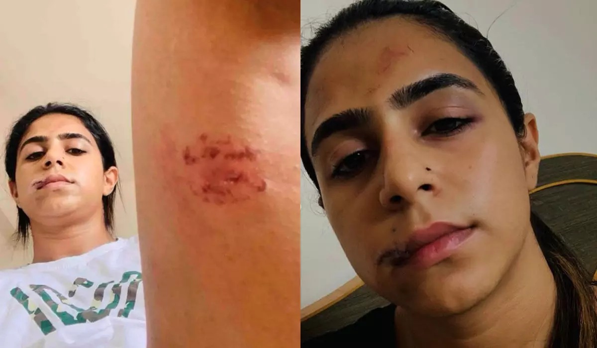 അയാള്‍ എന്റെ വയറ്റില്‍ ചവിട്ടി, തല തറയില്‍ ഇടിച്ചു, കക്ഷത്തും തുടകളിലും കടിച്ചു!